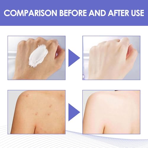 Intimate Area Dark Spot Corrector - Underarm Cream for Dark Armpit, Knees, Elbows, inner Thigh, Private Parts, Face, Bikini Line and Neck, Quick Results, 1.0 FL.Oz