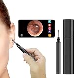 3. [Cámara HD de 5.0MP con 6 LED]: la cámara otoscopio ultra pequeña de 3.9 mm de diámetro tiene una cámara con sensor CMOS de 5.0MP y 6 luces LED, puede acceder fácilmente al canal auditivo, proporcionando una imagen más clara y una reproducción de color más excepcional sin importar cómo oscura es la oreja. Nota: La mejor distancia focal de la cámara es 055 "-0,787" （1,4 cm-2 cm) para capturar imágenes y videos claros.