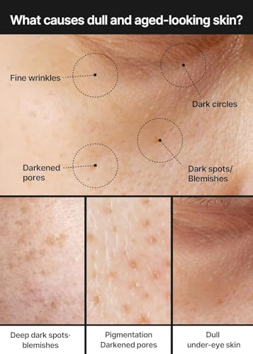 celimax Pore+Dark Spot Brightening Cream | with Niacinamide, Tranexamic Acid, TXA Cream, Pore Minimizer, Non-Irritating, Hydrating, For Sensitive Skin, 35ml - Image 4