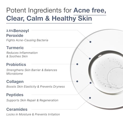 Image of WildOak 2.5% Benzoyl Peroxide Acne Face Body Wash | 300ml | Kills 99.99% Acne Germs | Fights Severe Bacne | Unclogs Pores & Prevents Breakouts | Scientifically Proven Non-Drying Formula
