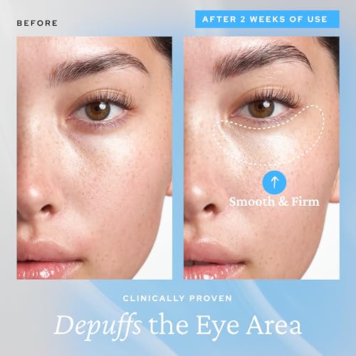 belif Aqua Bomb Cooling Eye Gel – Koffein & Hyaluronsäure gegen Schwellungen, Niacinamid & Vitamin C gegen Augenringe, Adenosin & Kollagen für mehr Straffheit, Koreanische Hautpflege (15 ml)