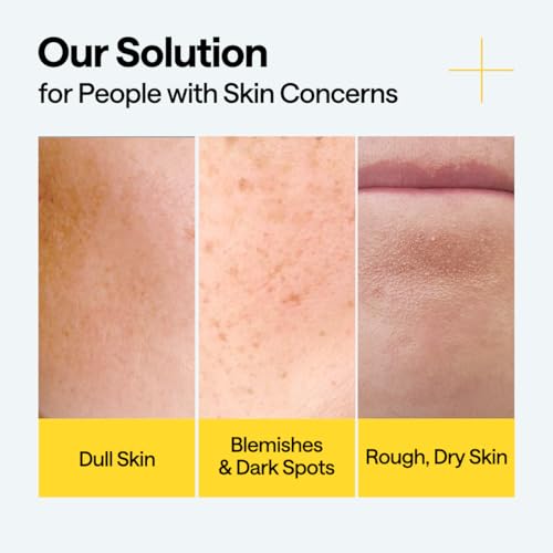 MEDIHEAL Vitamin C Brightening Serum (1.35 fl oz, 1 Pack) - Tone-Texture-Glow Care, Manage Skin with Vitamin C, Niacinamide, Hyaluronic Acid