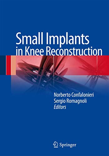 Small Implants in Knee Reconstruction view 2