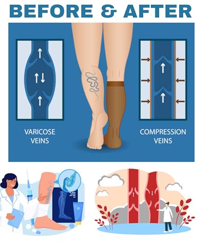 Tipi Toe 3 Pairs Compression Socks for Women & Men 12-14 mmHg Circulation Support Patterned Knee High Socks3