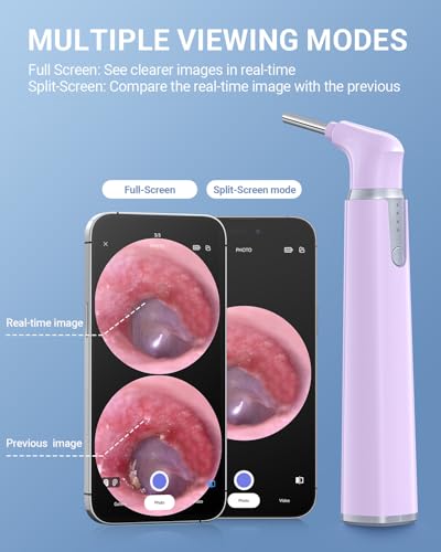 Image of ScopeAround Otoscope with Light, Ear Camera with Dual View, 720pHD WiFi Ear Scope with 6 LED Lights, 3.9mm Lens Otoscope Camera for Kids and Adults, Ear Scope Compatible w /iPhone and Android Pink