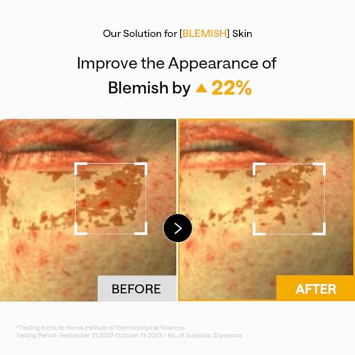 Image of Mediheal Vita Collagen Under Eye Patches for - Korean Hydrogel Eye Pads (60 patches) with 7 Vitamin & 5 Micro Collagen. Moisturizng & Non Irritating Eye Gel Mask. Sealing Cap Included.