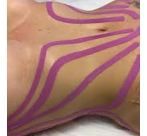 Fita Tapping Pós Cirúrgica Bandagem Elástica Fisioterapia Hipoalergênica Resistente à Água Recuperçã