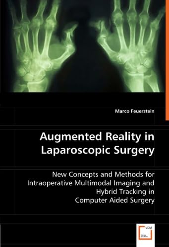 Augmented Reality in Laparoscopic Surgery: New Concepts and Methods for ...