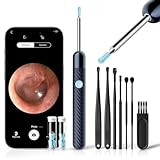 Otoscopio 1080P HD Limpiador de Oídos con Cámara de 6 LED - Limpiador de Oídos Adultos con 11 Fundas de Silicona - Compatible con iOS y Android (Azul)