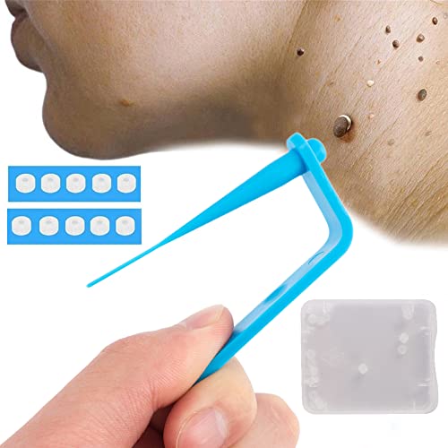 Skin Tag Remover, Kit de Eliminación de Etiquetas de Piel, Skin Tag Removal Kit 10 Hisopos Limpiadores y 10 Lingettes Nettoyantes Cover