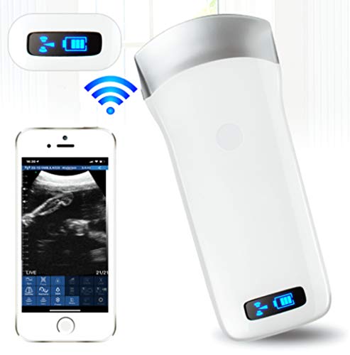 Best Ultrasound Machine For Phone