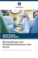 Behandlung von Phyllodentumoren der Brust 6209264859 Book Cover