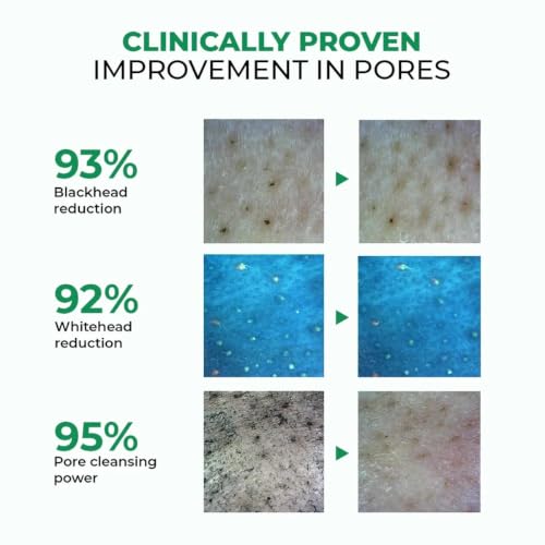 Image of Conscious Chemist Zero Pore Ultra Light Oil Cleanser | 60ml Pore Cleansing & Oil Control Face Cleanser with LHA, Niacinamide & Panthenol | Unclogs Pores, Refines Texture | For Men & Women, All Skin Types | Pack of 2