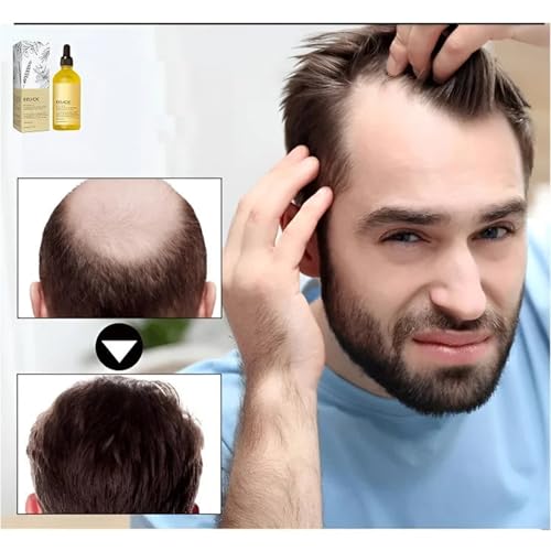 LOVILDS Rosemary Hair Growth Essence, Lovilds Rosemary Hair Growth Oil - 2 Ounce, Rosemary Rosemary Hair & Hair Strengthening Oil for All Hair Types (1 Bottle)