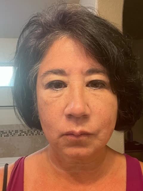 Cinta para levantar párpados