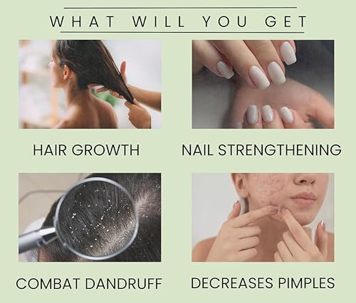Image of Rosemary Essential Oil 100% Pure & Natural - Hair Growth, Skin Care & Aromatherapy - Undiluted, Steam Distilled - For Diffuser, Scalp & DIY - 30ml