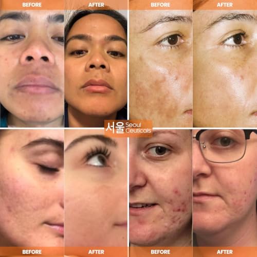 SeoulCeuticals Korean Skin Care 20% Vitamin C Serum - Image 3