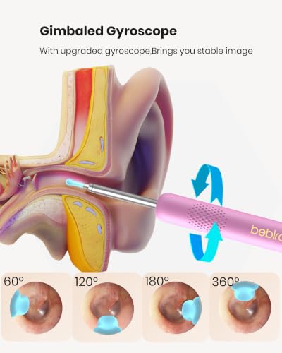 Image of BEBIRD R1 Wax Removal Tool for Ear - Spade Ear Canal Cleaner with Camera 1080P Earscope, Wax Remove Ear Picker with Vari Replacement Tips, Camera with 6LED Light, Pink