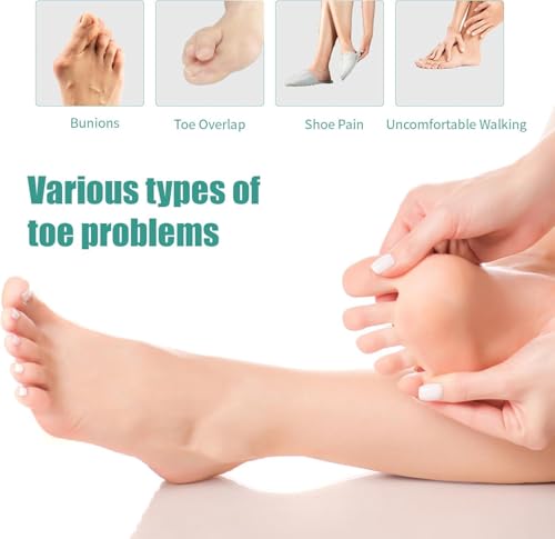 Image of 4 Pcs Silicone Toe Spacers - Yoga Toe Separators for Toe Straightening & Relaxation | Correct Overlapping Toes, Bunions, Hammer Toe | Toe Support toe separators for Women & Men (Tan, 3.98)