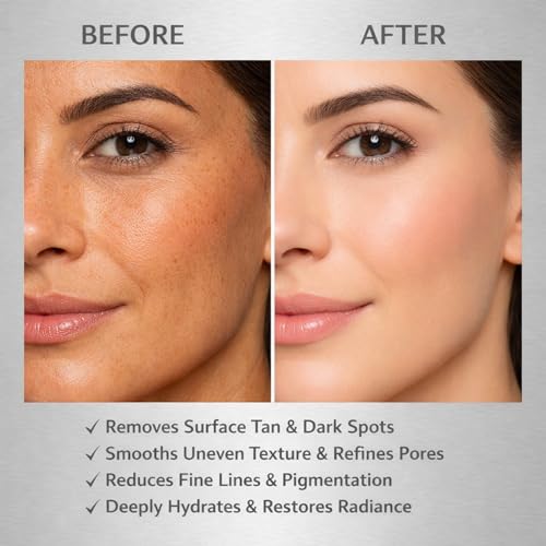 Image of NutriGlow Facial Kit for Glowing Skin And Tan Removal, Suitable for All Skin Types, Complete At-Home Bridal Facial Set for Men & Women, Pack of 5 Variants 60g Each