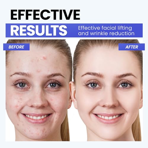 Gunfay GUNFAY-O1 Microcurrent Facial Device,Latest Red Light Technology,Enhances The Ability To Lift The Face And Tighten The Skin,Usb Red Light Device thumb #4