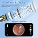 LMECHN 1920P HD Ear Wax Removal Tool with Camera, Slim Wireless Ear Otoscope, 6 Lights, IP67 Waterproof Ear Cleaner with 8 Skin-Friendly Silicone Scoops for iPhone, iPad & Android. gallery 2