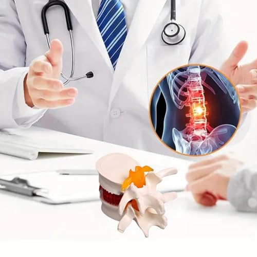 Image of Herniated Disc Spine Model, 1.5X Life Size Lumbar Spine Anatomy Model for Teaching, Chiropractic Demonstration, Medical Learning and Patient Education (1pc Spine and Disc Model)