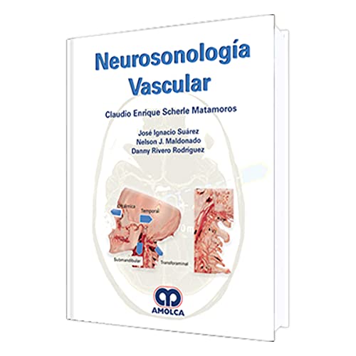 Neurosonologia Vascular