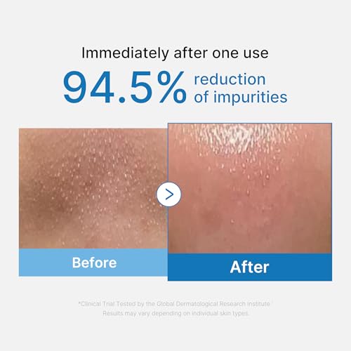 medicube Cleansing Oil Zero Pore Blackhead Reinigungsöl 205 ml – Ansicht 2
