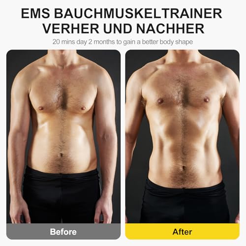 Unegnel Elettrostimolatore Muscolare,Elettrostimolatore Addominali Con 10 Modalità E 30 Intensità,Ems Elettrostimolatore Muscolare Usb Ricaricabile, Uomo Donna Attrezzo Fitness Home - 2