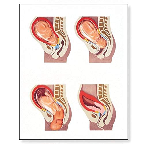Tableau de anatomique du Processus de la naissance poster grand format V2048M suspendu en bois
