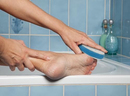 Iconikal 6-Pack Pumice Exfoliating Stone with Rubber Grip (Blue)