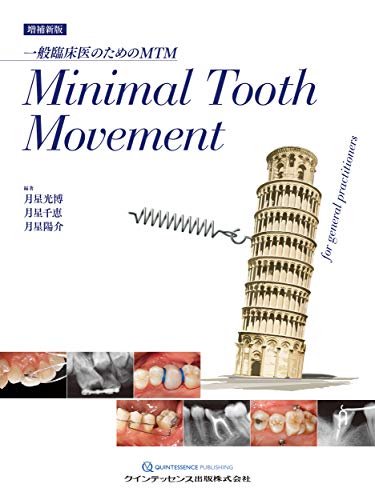 増補新版 Minimal Tooth Movement
