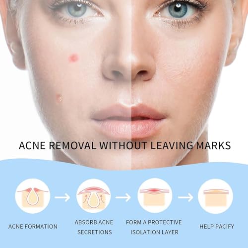 Safirst Zit Patch Hydrocolloid Acne Patches 2 Sizes Invisible Spot Blemish Stickers Easy Removal Treatment for Breakouts Absorbs Zits Hiding Face Emergency Treatments — view 3