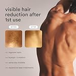NEW Nood™ Flasher Pro — IPL Laser Hair Removal Device for Women & Men with Sapphire Cooling — Pain-free & Permanent, Visible Results After First Use & Works Everywhere Hair Grows — Gloss White - Image 3