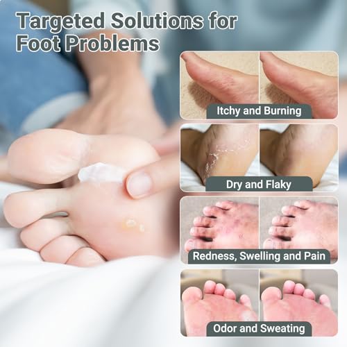 Image of ishancare Extra Strength Antifungal Foot Cream (0.7oz) - Natural Herbal Treatment for Athlete's Foot - Relieves Itching, Burning, Cracking & Fungal Infections