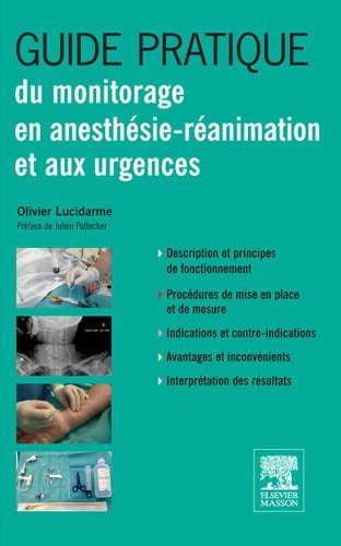  Guide pratique du monitorage en anesthésie-réanimation et aux urgences (Pratique en anesthésie, r Francais PDF