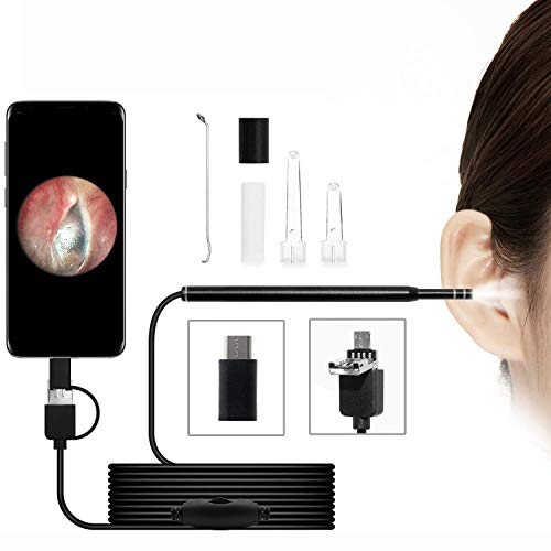 What's The Best Digital Otoscope For Android By An Expert