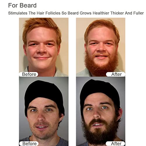 Rollnewskin Dermaroller per capelli e barba