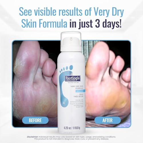 Footlogix Very Dry Skin Mousse Formula 125ml Contains Urea To Hydrate. Ideal For Seniors, Non Greasy & No Residue. Safe For All Skin Types & Absorbed Into All Layers Of The Skin