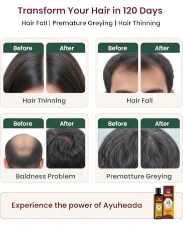 Image of Herbal Hair Oil for Hair Growth & Hair Fall Control | Enriched with Bhringraj, Amla, Brahmi & 16 Ayurvedic Herbs | Promotes Strong, Thick & Healthy Hair | Improves Scalp Health | 100 ml