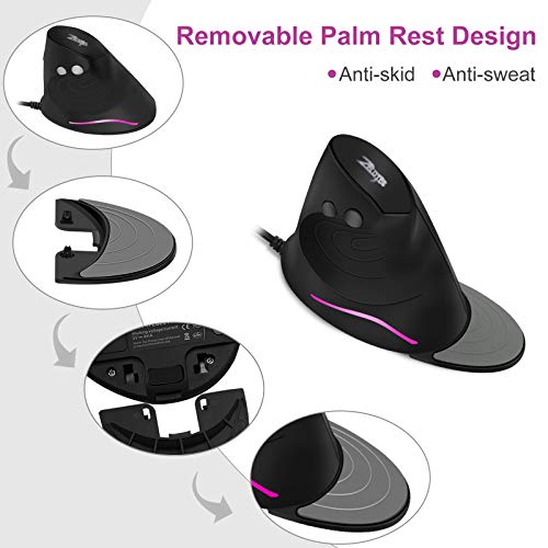 Trelc Vertical Ergonomic Optical Mouse With 6 Programmable Buttons, 800-3200 Dpi, Removable Palm Rest & Thumb Buttons, Reduces Wrist Pain, Rgb Vertical Mice Wired For Pc, Desktop, Laptop (Wired) #TOP6