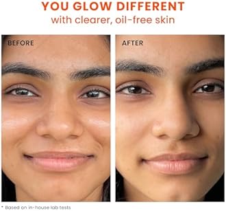 Foxtale SPF 70 Gel-Cream Sunscreen for Oily Skin | Oil Control Sunscreen with PA++++ & Niacinamide | UVA UVB Protection | Prevents Tan | Lightweight, Pore-minimising, No White Cast | 50ml (Pack of 2)