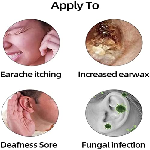 Japanese Ear Ringing Treatment Oil - 10Ml Organic Ear Oil, All Natural Herbal Ear Ringing Remedy Drops, Ear Ringing Oil To Help Stop Ear Ringing, Hearing Loss, Eases Pain, Unclogs Ears (3Pcs) #TOP6