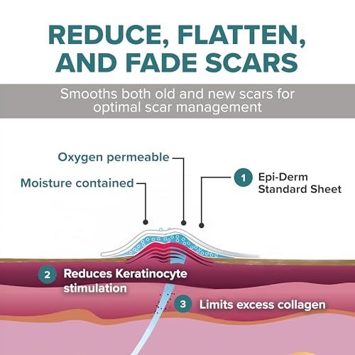 EpiDerm Standard Silicone Scar Sheets – Soft Reusable Premium Silicone Gel Sheets for Tummy Tuck, C-Section, Hysterectomy & Surgical Scars – Flexible Fit & Easy to Clean - 4.7" x 5.7", Natural, 5-Pack