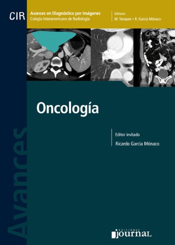 Avances en Diagnostico por Imagenes 11: Oncologia