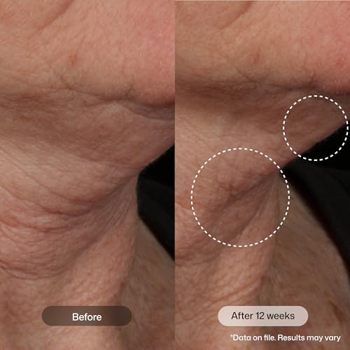 Image of Revision Skincare Nectifirm Advanced Neck Cream - Clinically Proven to Firm, Lift & Contour the Neck, Jawline & Decolletage, Correcting Visible Signs of Aging and Weight Loss