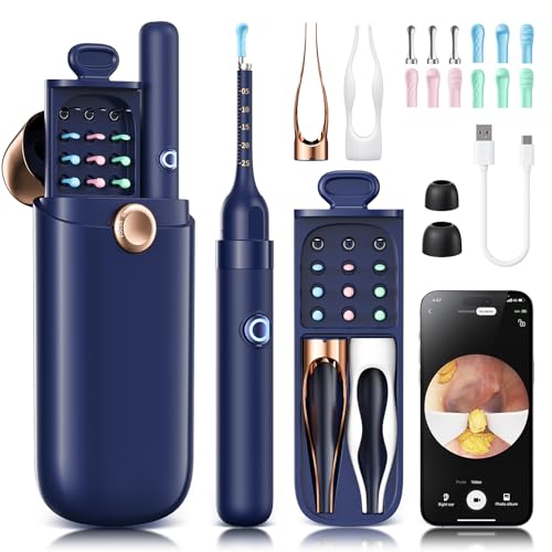 Loyker Ear Wax Removal Ear Cleaner with 1080P Camera Ear Cleaning Kit with 12 Ear Pick Visual Ear Picker Earwax Remover Tweezers with 6LED Light Ear Camera for iPhone iPad Android Phones Blue