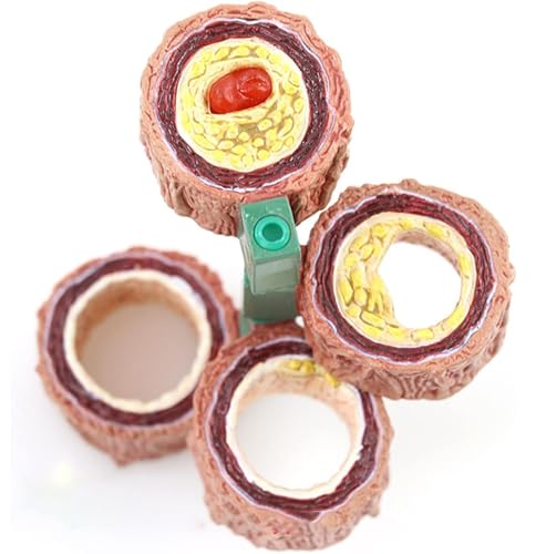 Genérico Modelo de Arteria de 4 Piezas, Modelo de Aterosclerosis con Acumulación de Placas, Modelo de Anatomía de Vaso Sanguíneo Humano, Modelo de Anatomía para Consultorios Médicos