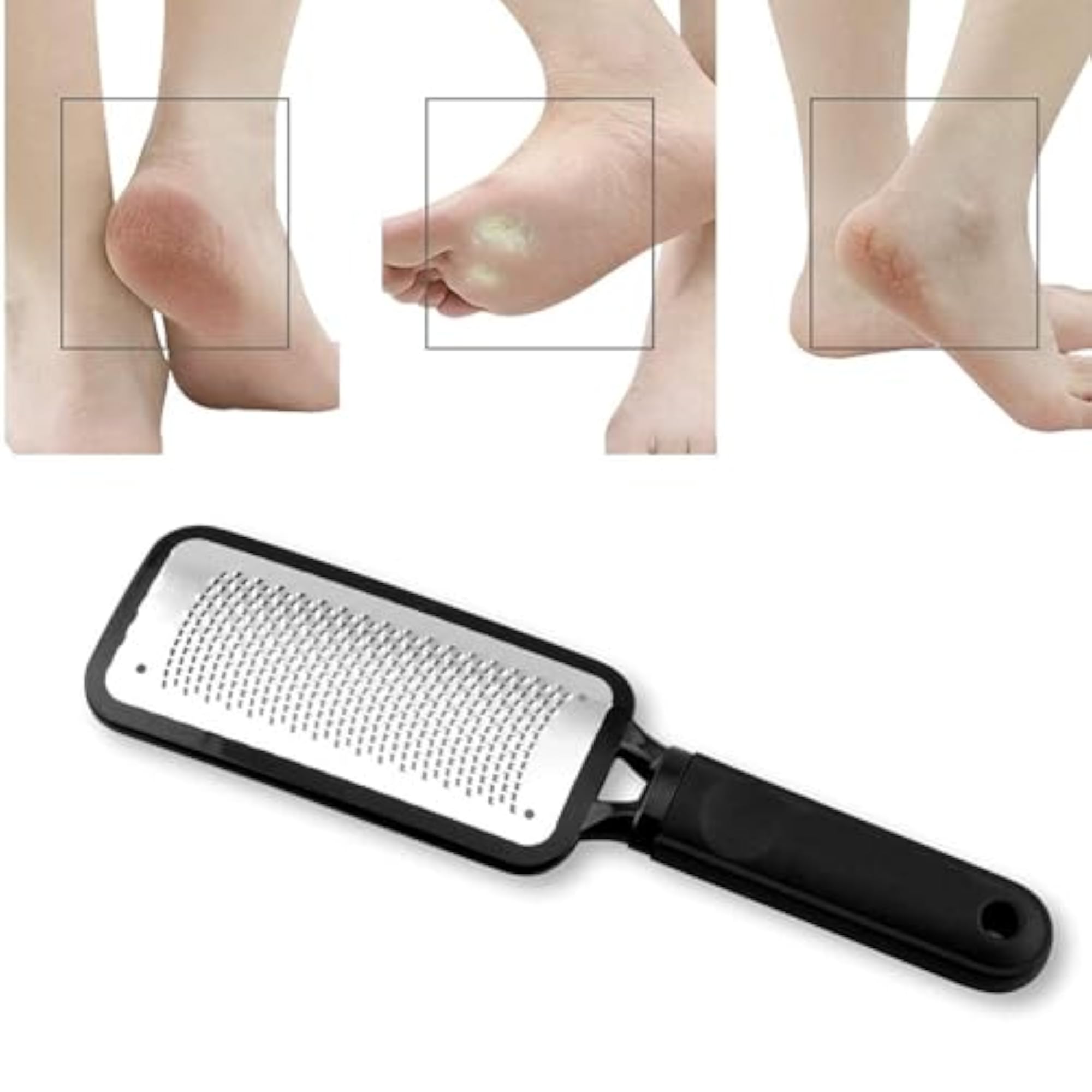 Foot Scrubber Callus Remover with Stainless Steel, Pack of 3